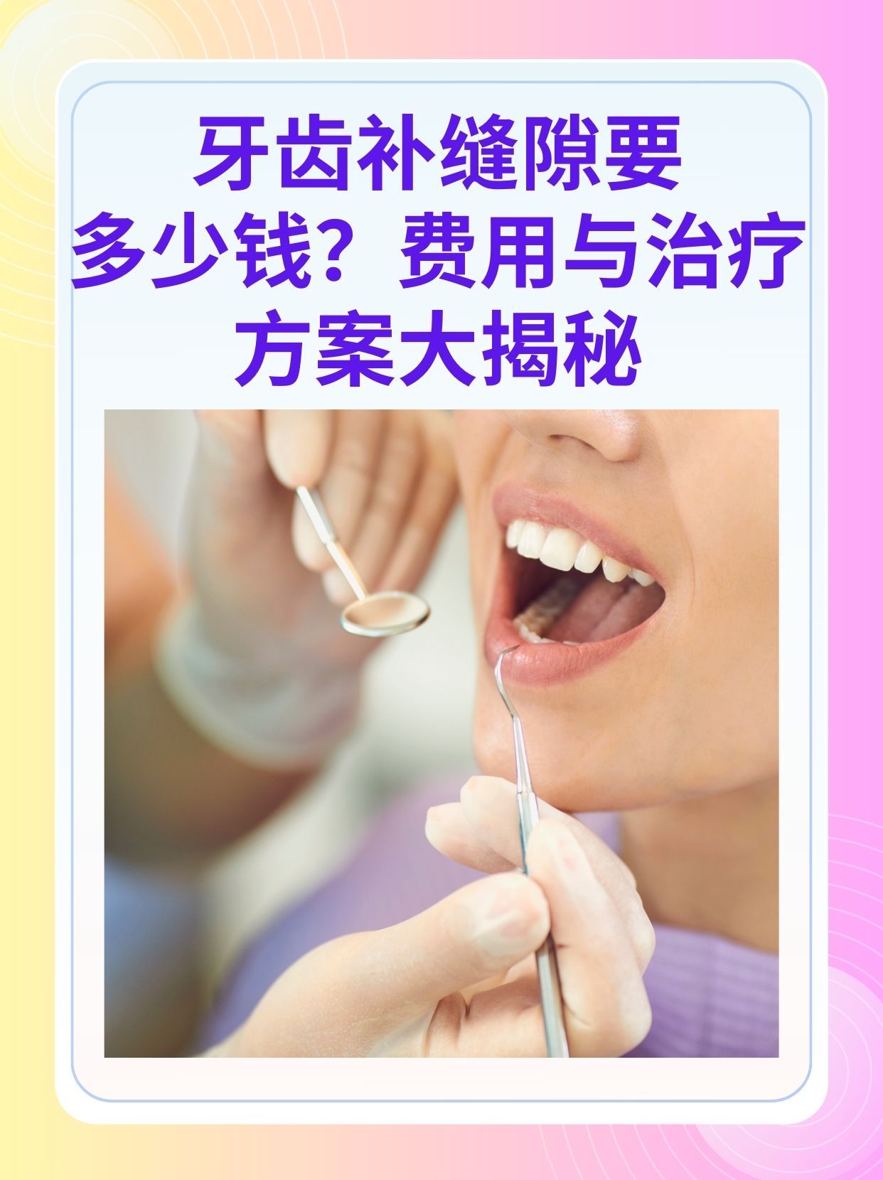 邯郸补牙医保可以报销吗(补牙医保可以报销吗 哪些可以报销呢)